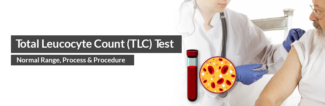  Total Leucocyte Count (TLC) Test - Normal Range, Process, Procedure